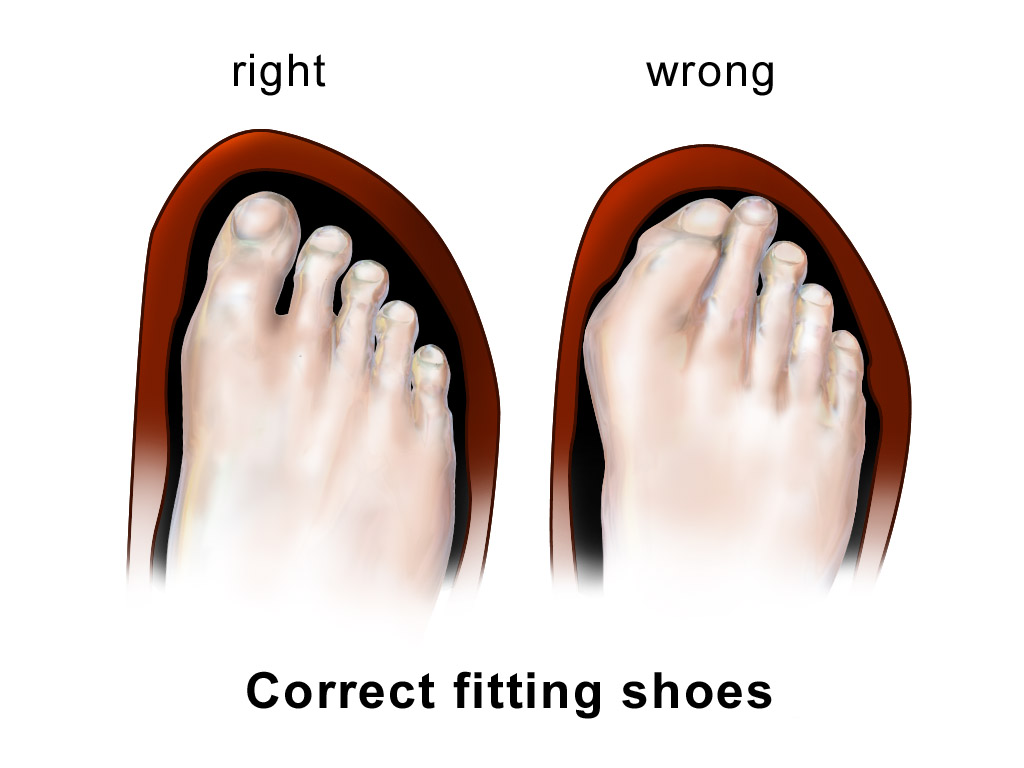 Make Sure Your Shoes Fit Properly